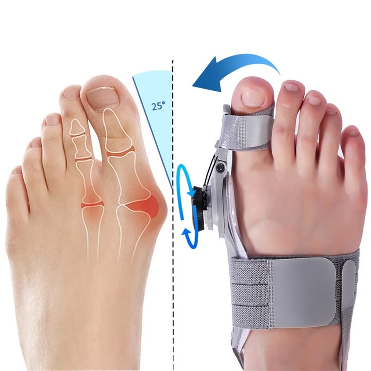 BuNION SPLINT & TOE CORRECTER